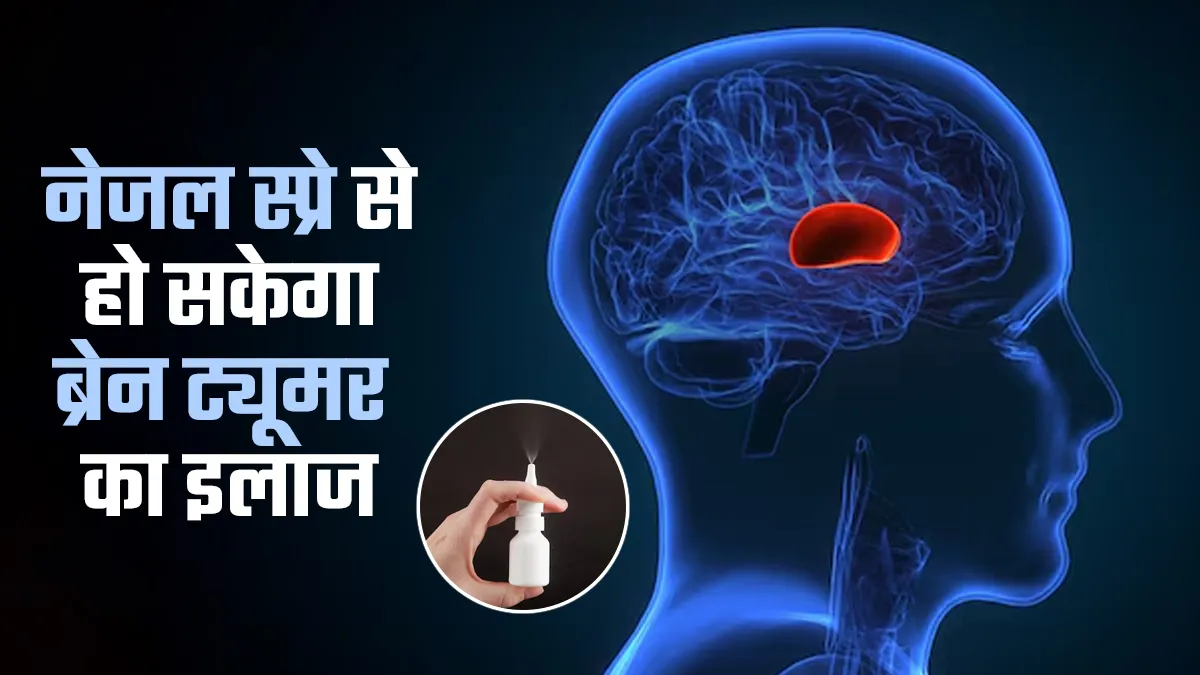 Brain Cancer Nasal Spray: बिना सर्जरी दिमाग के ट्यूमर पर असर, नई रिसर्च में क्या आया सामने?