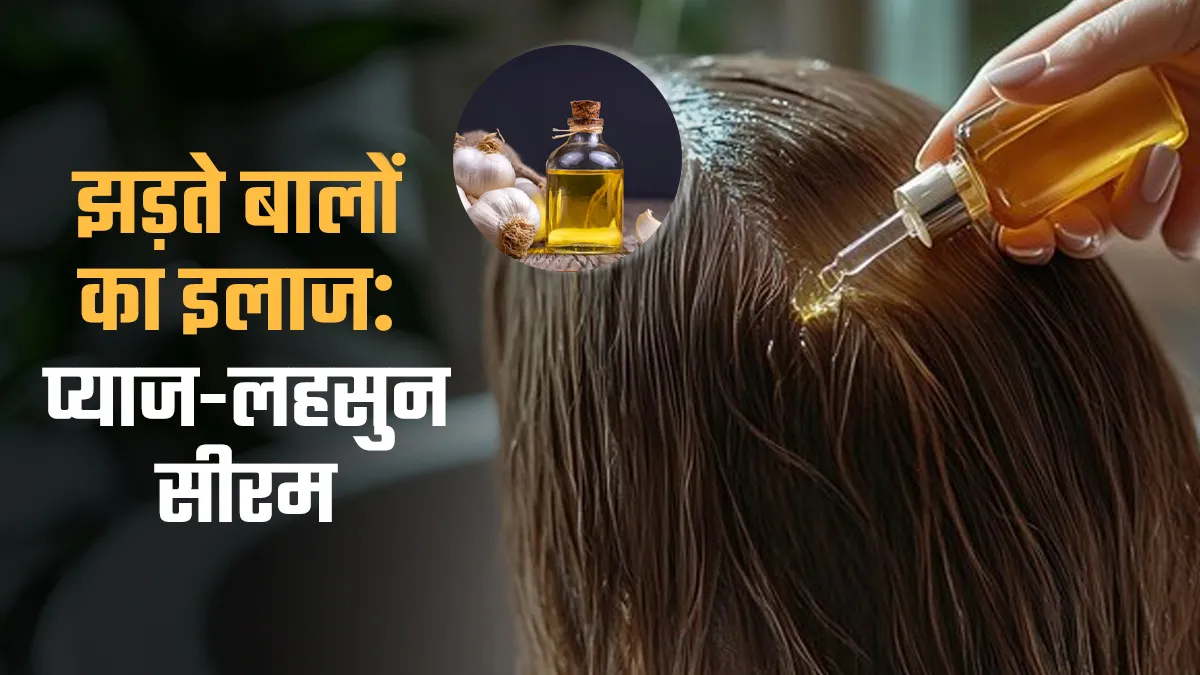 Hair Growth Serum: प्याज-लहसुन हेयर सीरम से झड़ते बाल कैसे रोकें? आयुर्वेदिक एक्सपर्ट से जानें