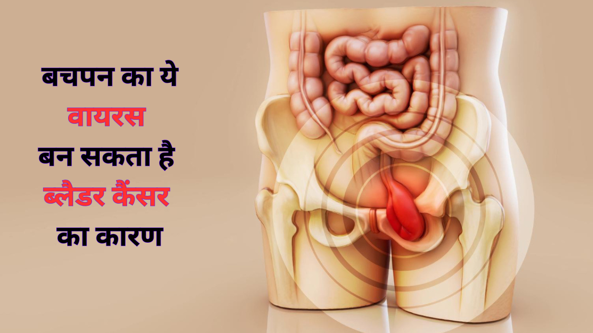 बचपन में हुआ ये इंफेक्शन बन सकता है आगे चलकर Bladder Cancer का कारण, स्टडी में सामने आया सच