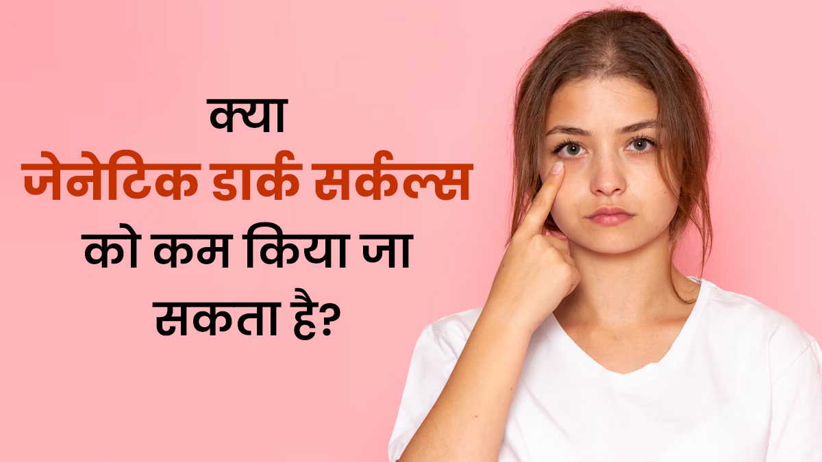 क्या जेनेटिक डार्क सर्कल्स को कम किया जा सकता है? जानें डर्मेटोलॉजिस्ट से