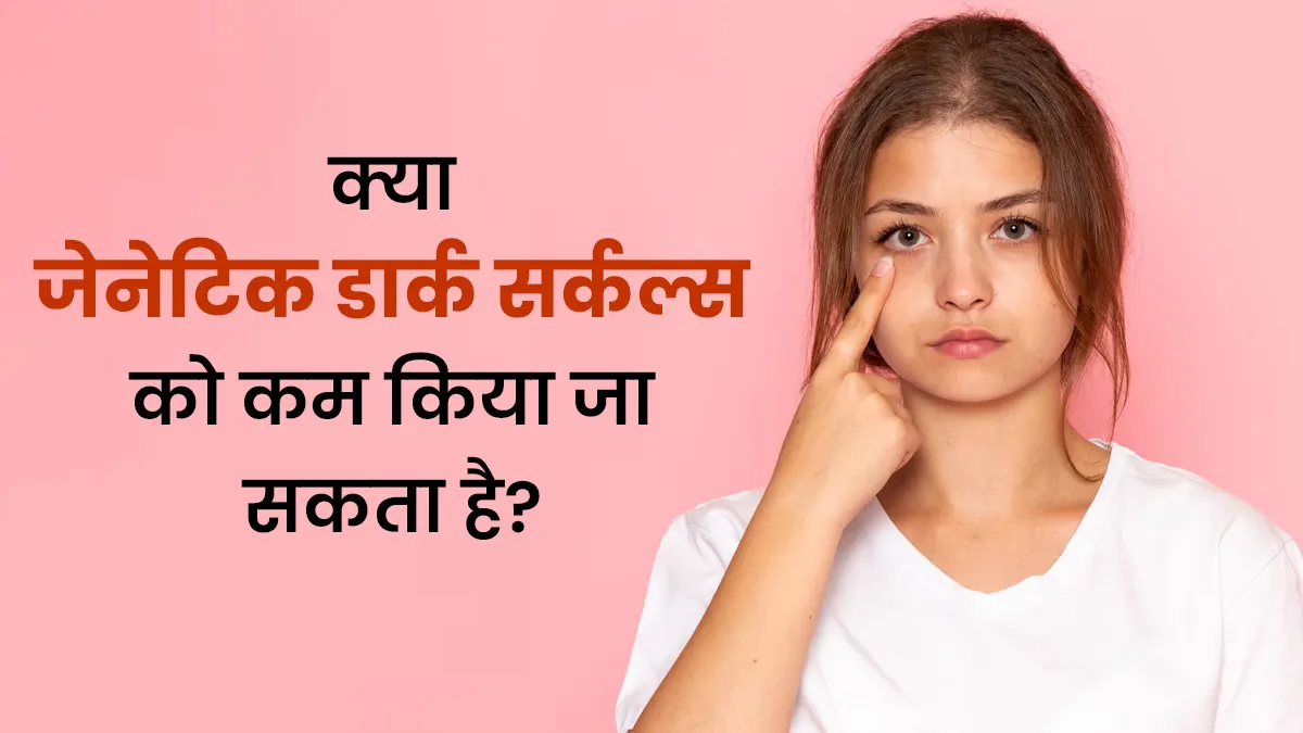 क्या जेनेटिक डार्क सर्कल्स को कम किया जा सकता है? जानें डर्मेटोलॉजिस्ट से