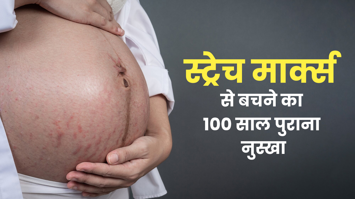 घी स्ट्रेच मार्क्स कम कर सकता है? दादी-नानी ने बताया है प्रेग्नेंसी के दौरान इससे बचने का सबसे कारगर नुस्खा