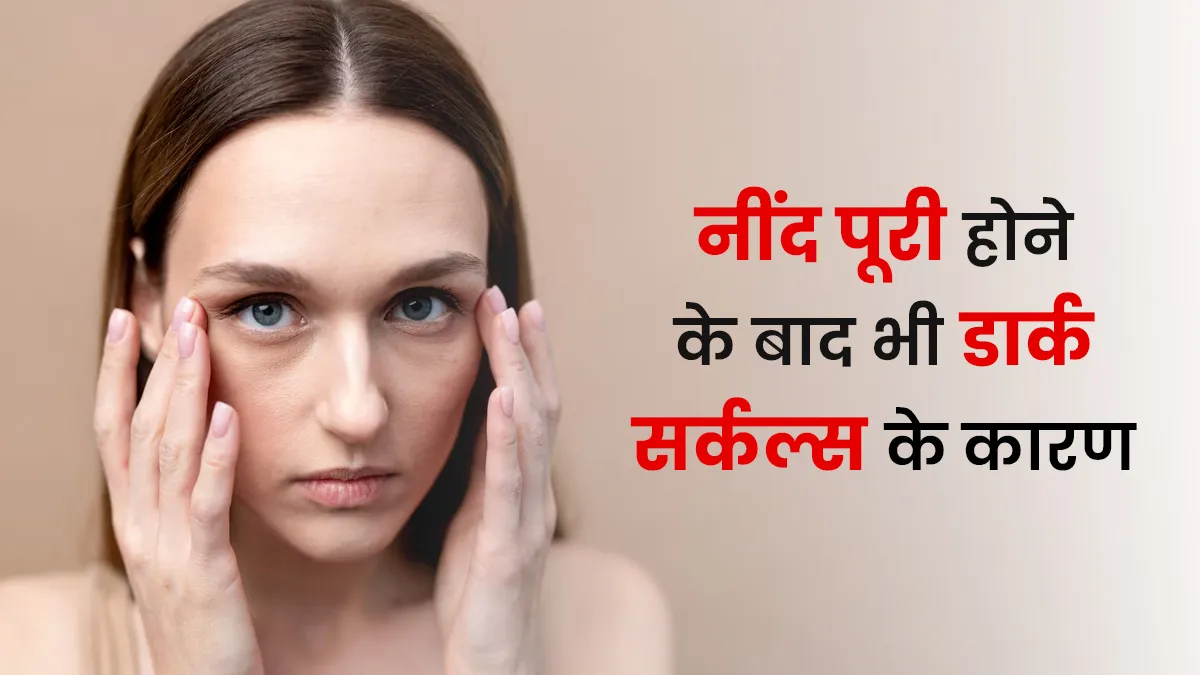 नींद पूरी होने के बाद भी आंखों के नीचे पड़े हैं काले घेरे? डॉक्टर से जानें इसका कारण