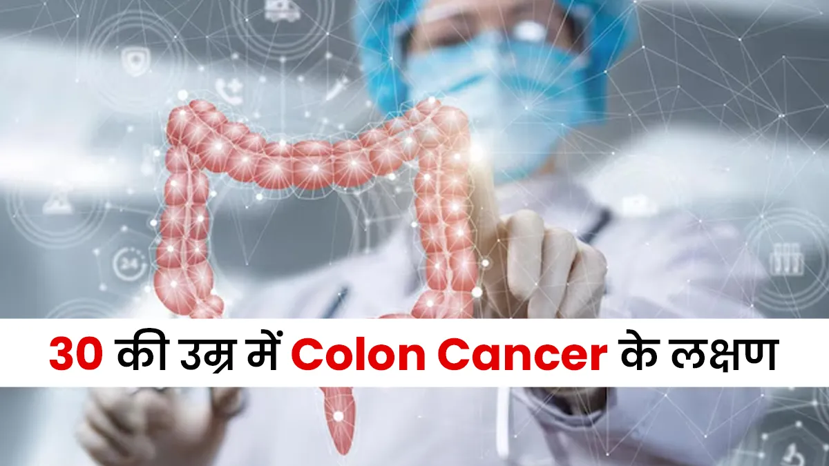 30 की उम्र में Colon Cancer के इन 5 लक्षणों को बिल्कुल न करें इग्नोर, जानें डॉक्टर से