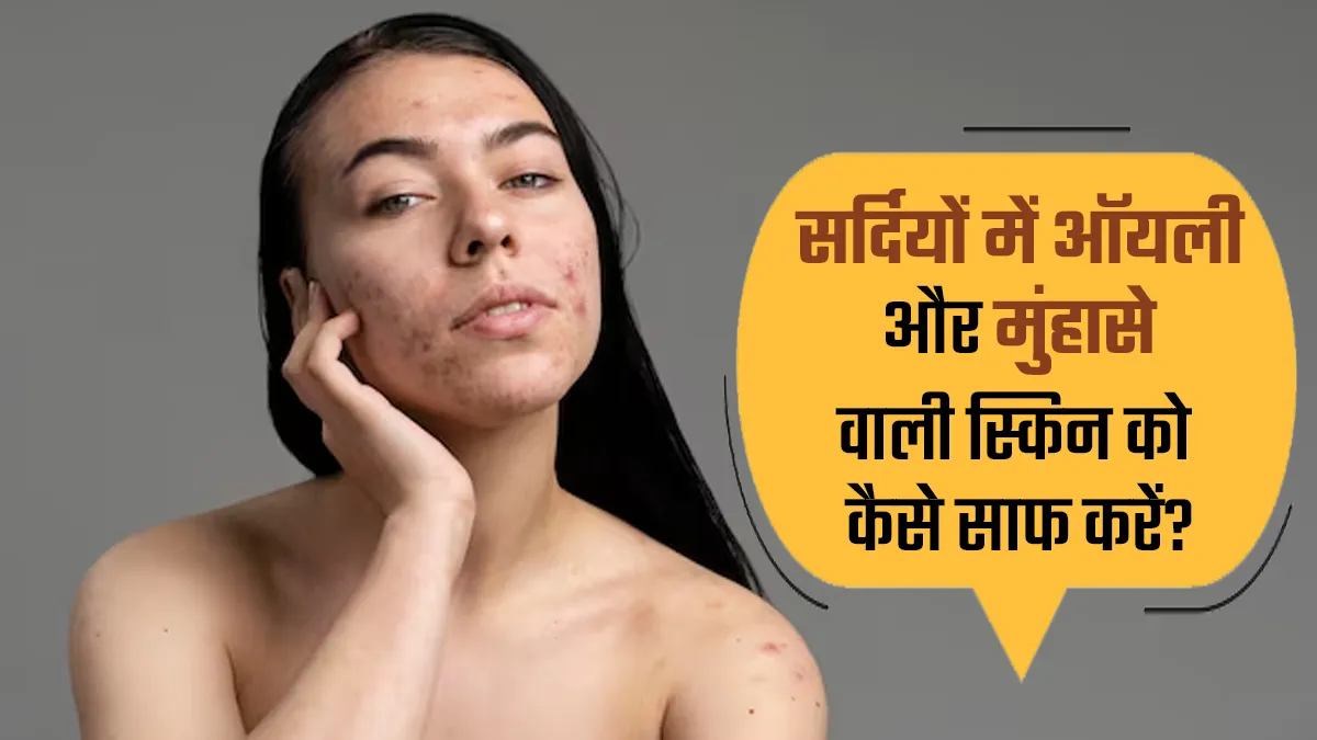 ऑयली और मुंहासे वाली त्वचा को सर्दियों में कैसे साफ करें? एक्सपर्ट से जानें