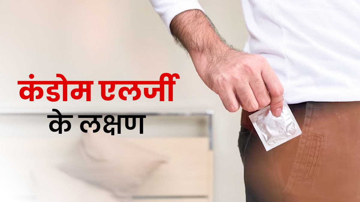 कहीं आपको तो नहीं है कंडोम से एलर्जी? ये 4 छुपे हुए लक्षण तुरंत पहचानें