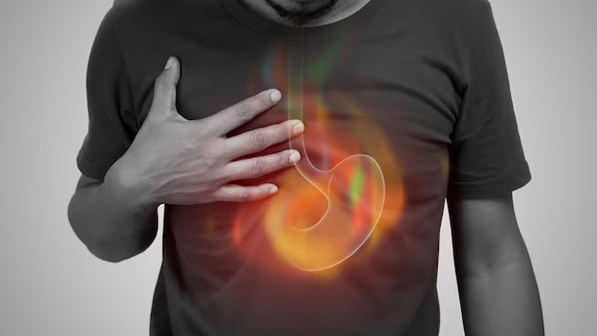 GERD bronchitis symptoms