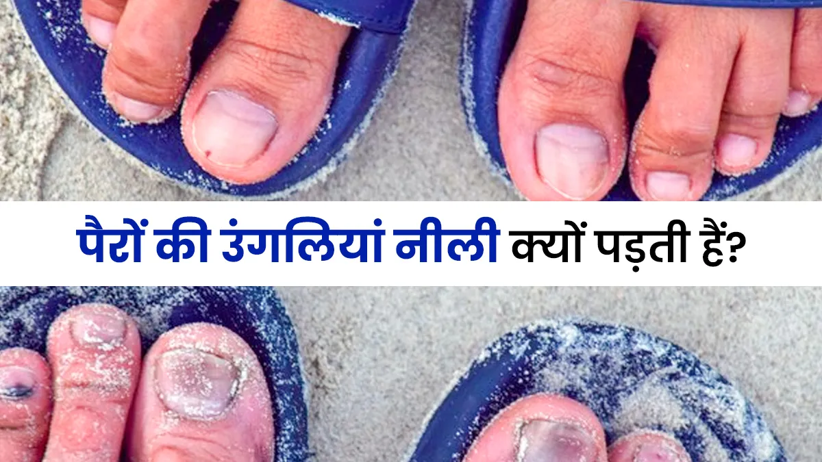 क्या आपकी भी पैरों की उंगलियां पड़ जाती हैं नीली? डॉक्टर से जानें इसके कारण