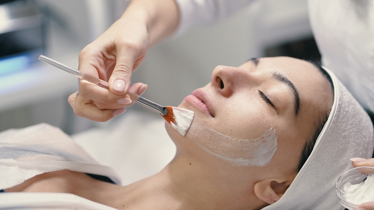 is chemical peeling safe at home