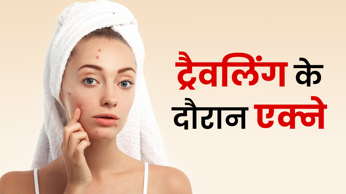 ट्रैवेल के दौरान मुंहासे का कारण बन सकती हैं ये 6 गलतियां, खूबसूरत सेल्फी चाहिए तो बचें इनसे