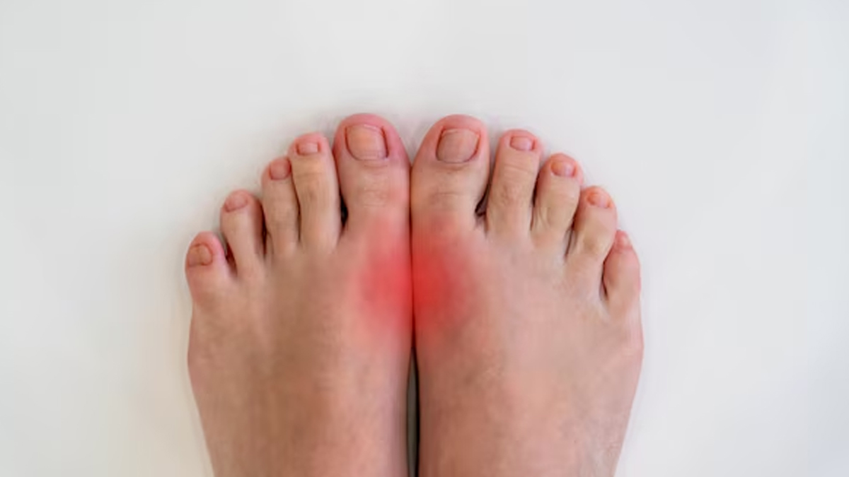 how to use alum for swelling in fingers and toes in winter in hindi 01 (5)