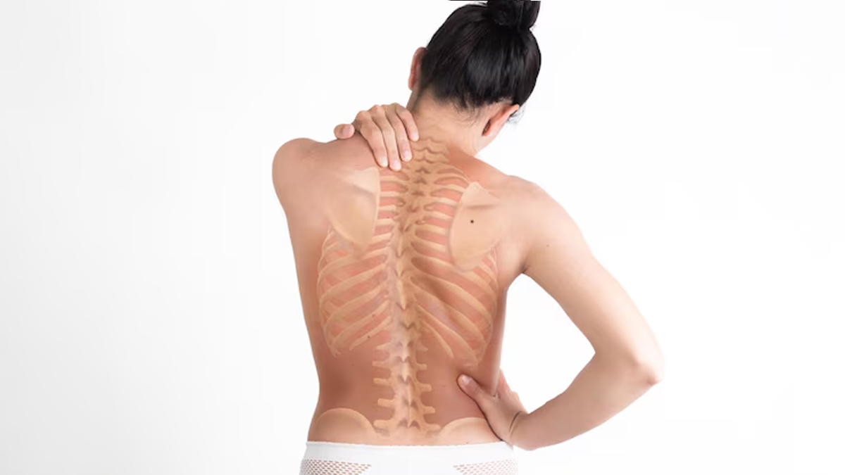 does poor posture cause scoliosis 01 (10)