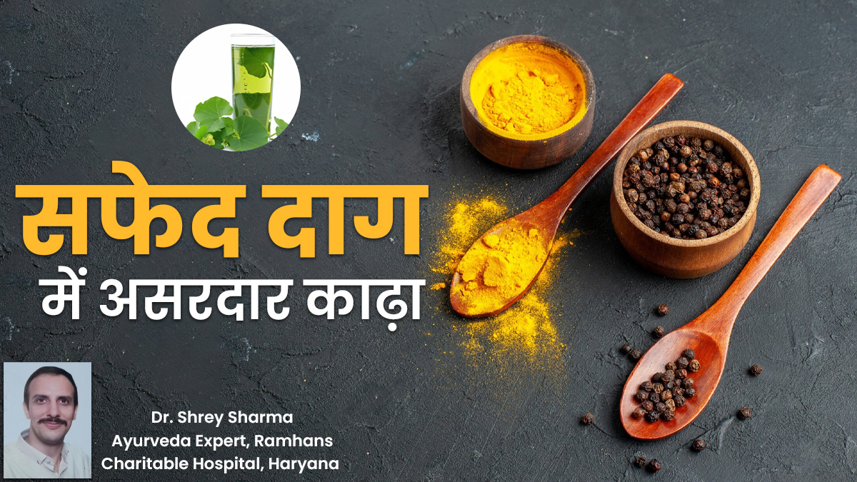 सफेद दाग में कौन-सा काढ़ा सबसे असरदार होता है? जानें आयुर्वेदाचार्य से