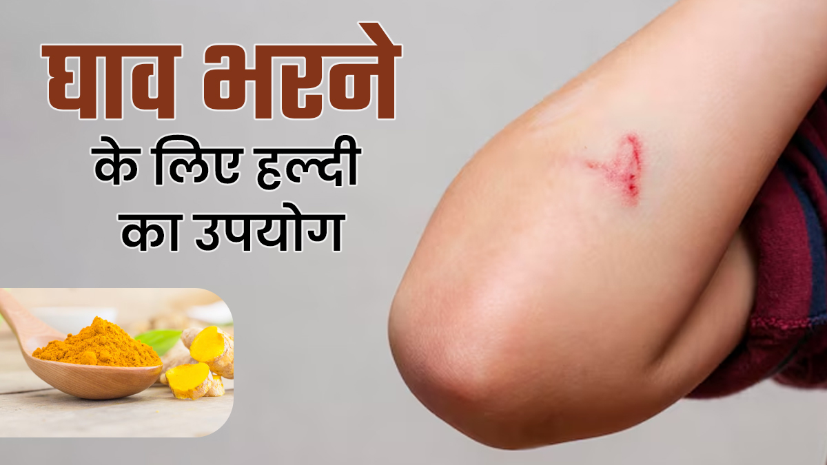 घाव भरने के लिए हल्दी का उपयोग कैसे करें? डॉक्टर से जानें