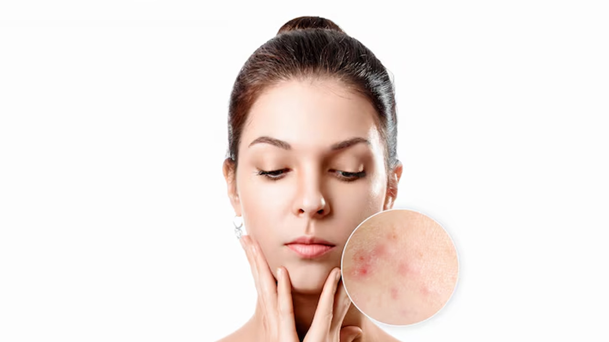 side effects of applying malai on face overnight 2 (3)