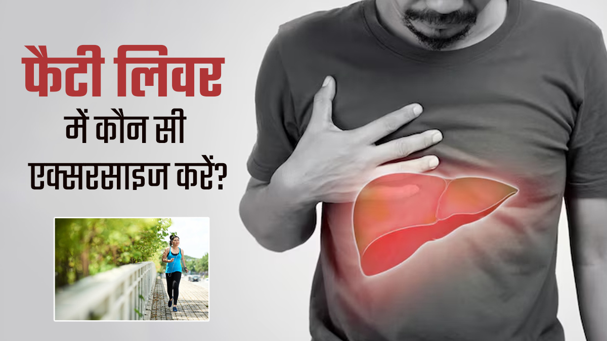 फैटी लिवर में कौन सी एक्सरसाइज करें? एक्सपर्ट से जानें