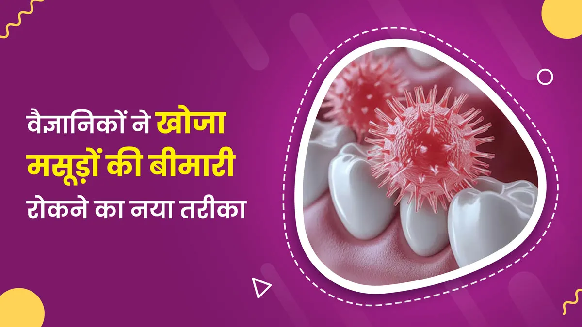 मसूड़ों की बीमारी में नया इलाज, गुड बैक्टीरिया को बिना नुकसान पहुंचाए