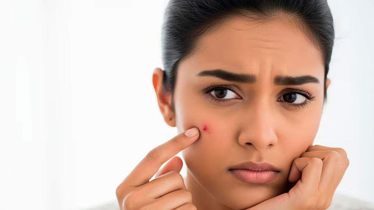 why to avoiding poping pimple INSIDE-7