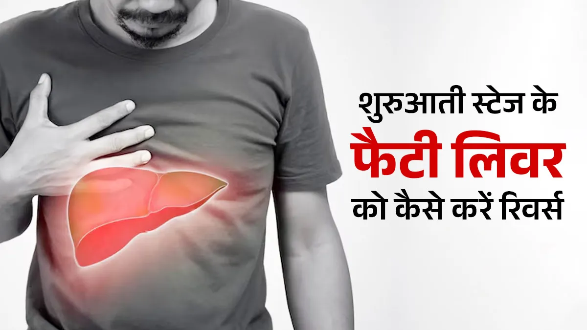 शुरुआती स्टेज के फैटी लिवर को रिवर्स करने के लिए क्या करें? डॉक्टर से जानें