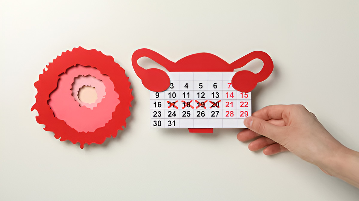 irregular-periods-causes