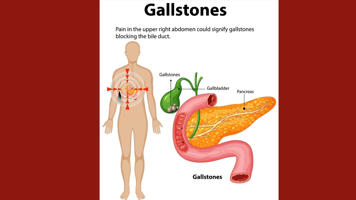 gallbladder disease