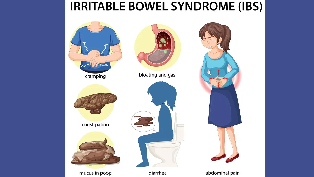 Is IBS Lifelong Condition