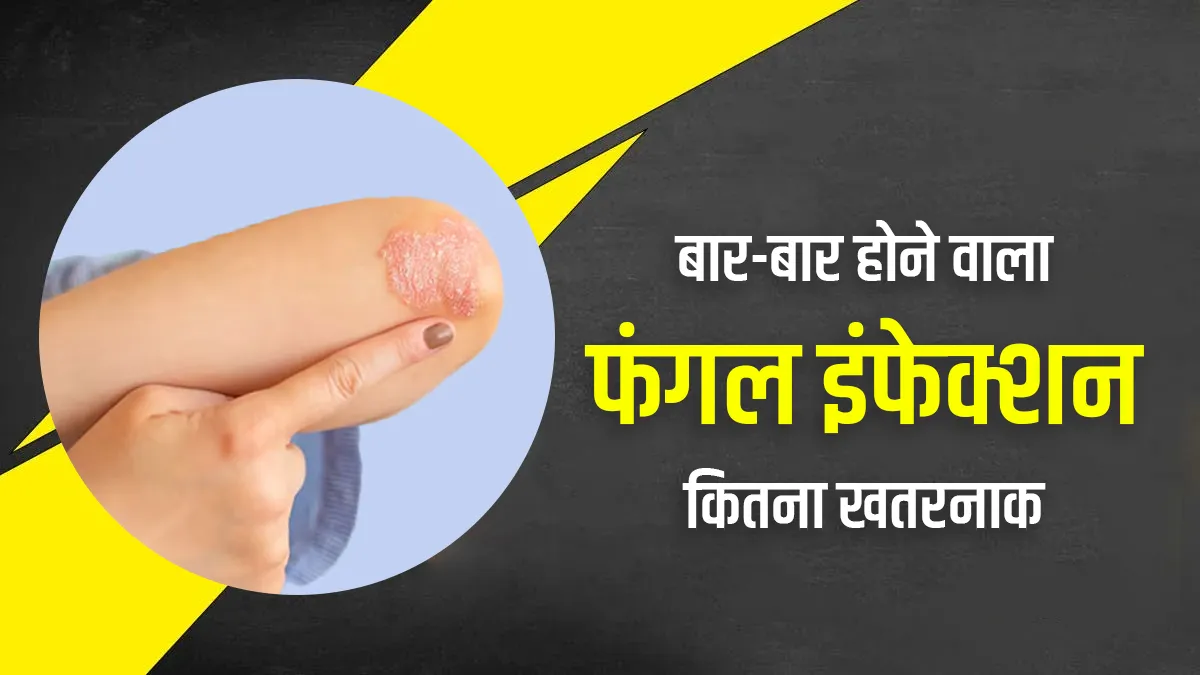 बार-बार फंगल इंफेक्शन होने के क्या कारण हो सकते हैं? क्या ये किसी गंभीर बीमारी का संकेत है