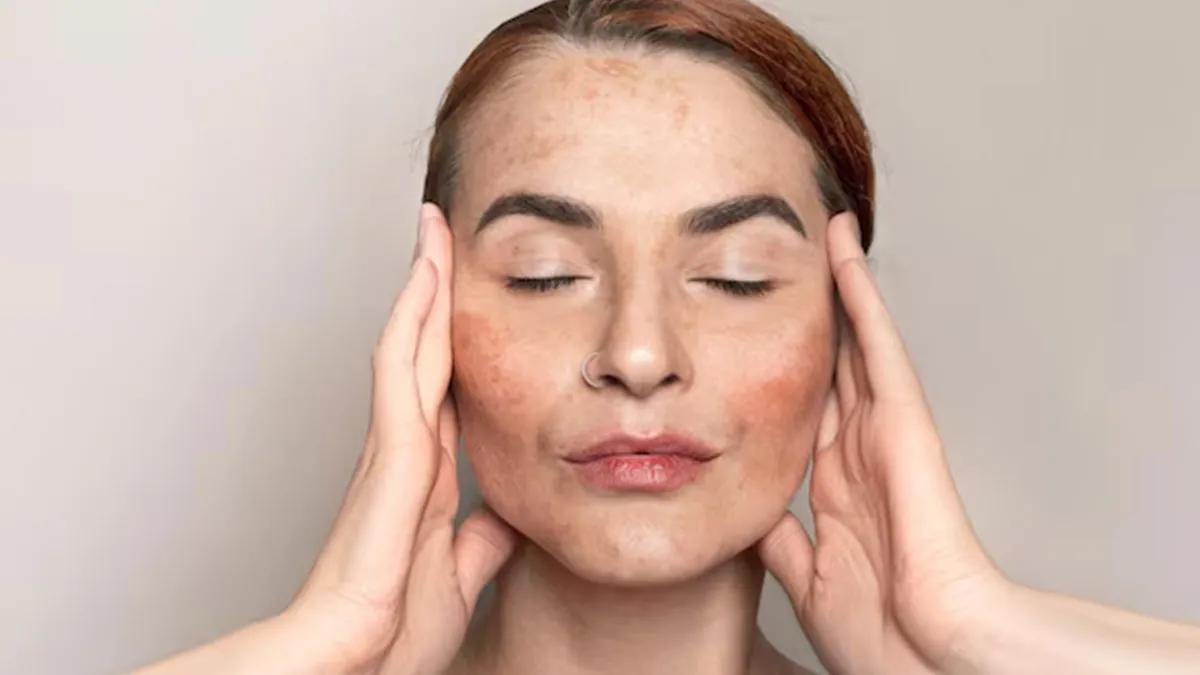 can vitamin deficiency cause change in skin colour 01