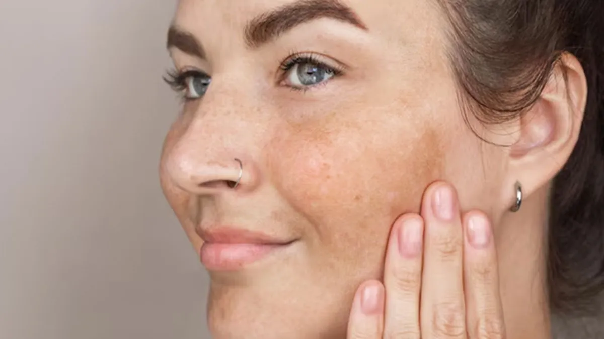 how to prevent sun induced pigmentation 01
