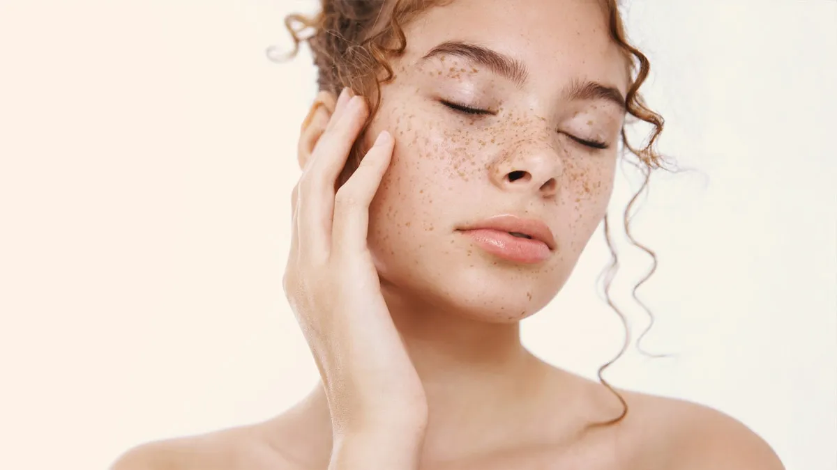 what is melasma know its symptoms 1 (4)