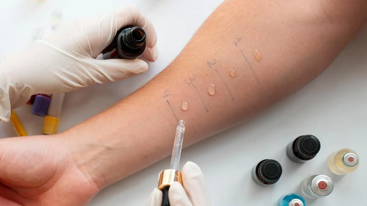 when should an allergy test be done know from doctor 1 (4)
