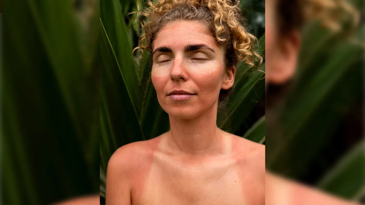 what is the difference between pigmentation and tanning  1 (4)