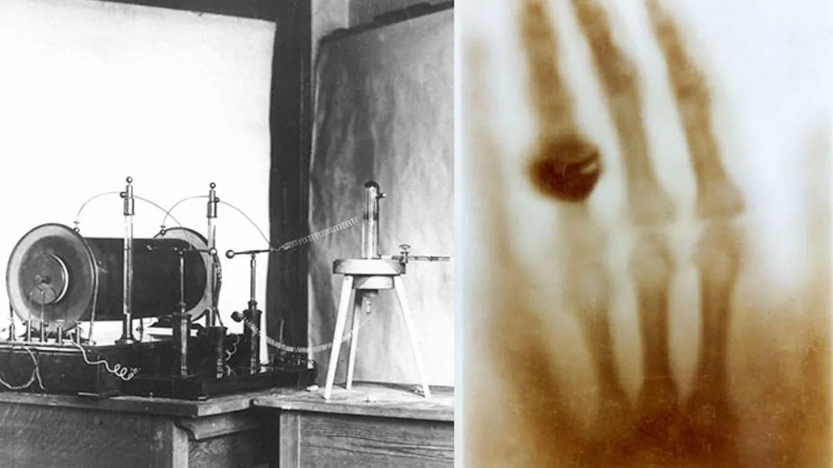 history-of-x-ray