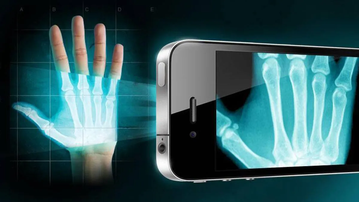 x-ray-discovery