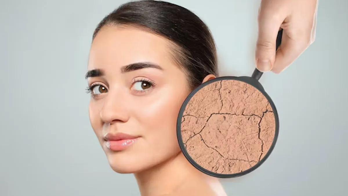 why does skin become dry as the weather changes 1