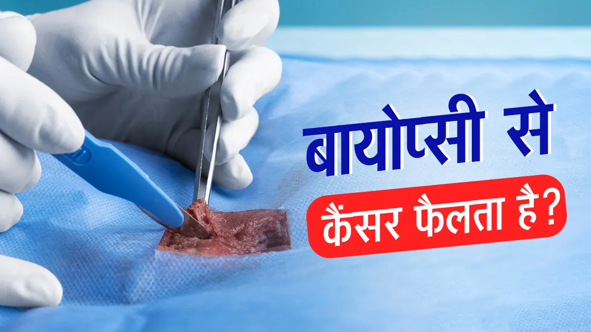 क्या वाकई बायोप्सी से कैंसर फैल सकता है? डॉक्टर से जानें दावे का सच और झूठ