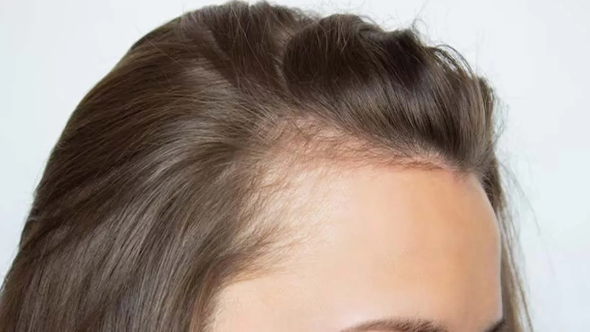thin-hair-treatment