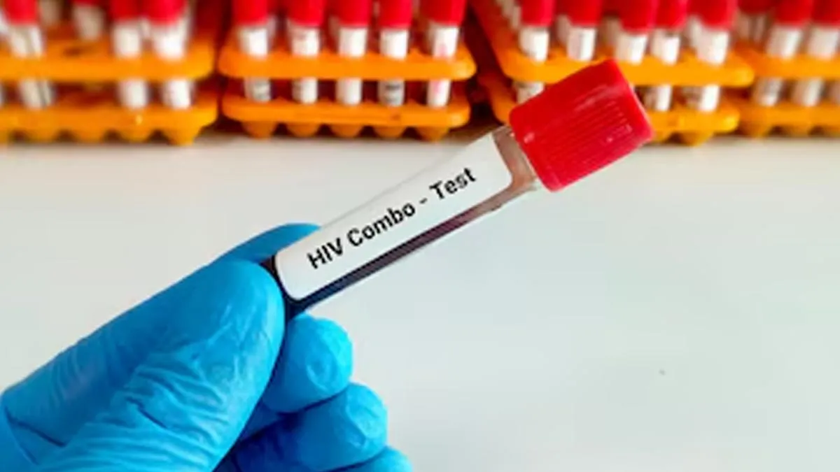 what is the difference between hiv and aids 01 (1)