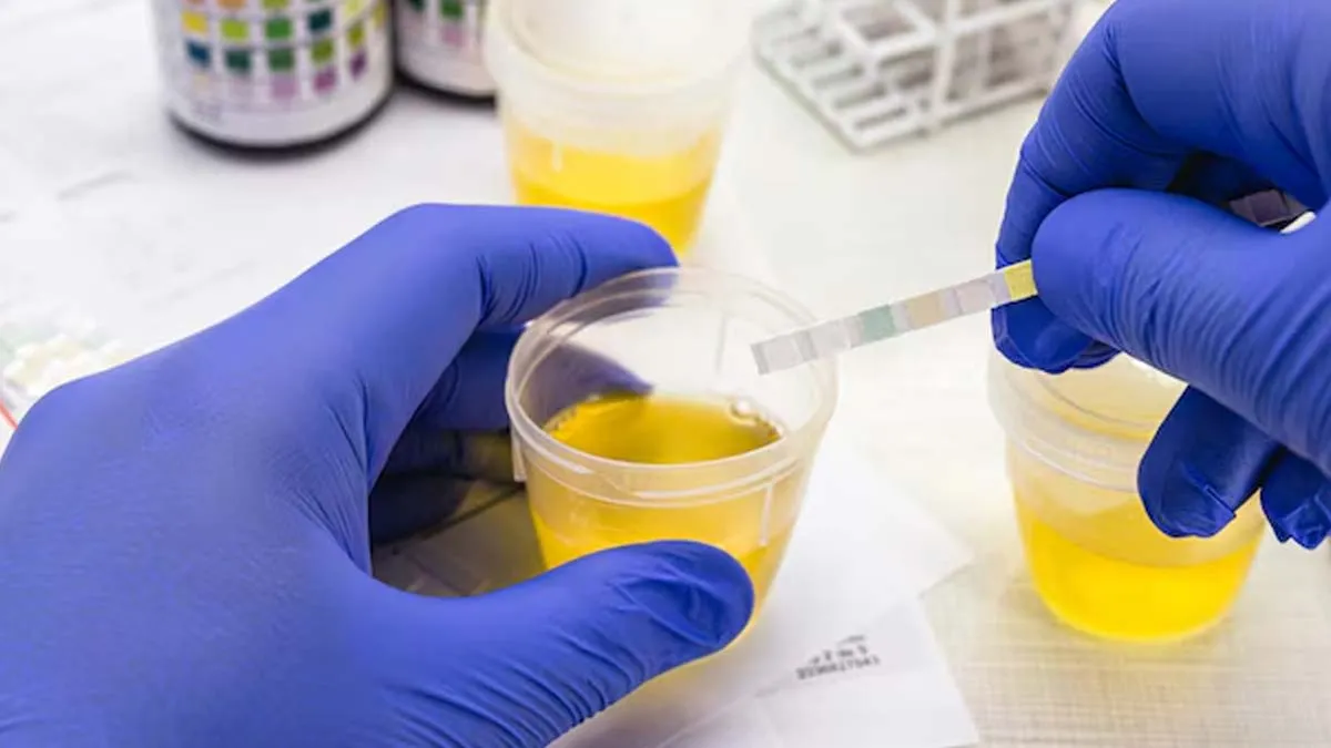 foul smell of urine