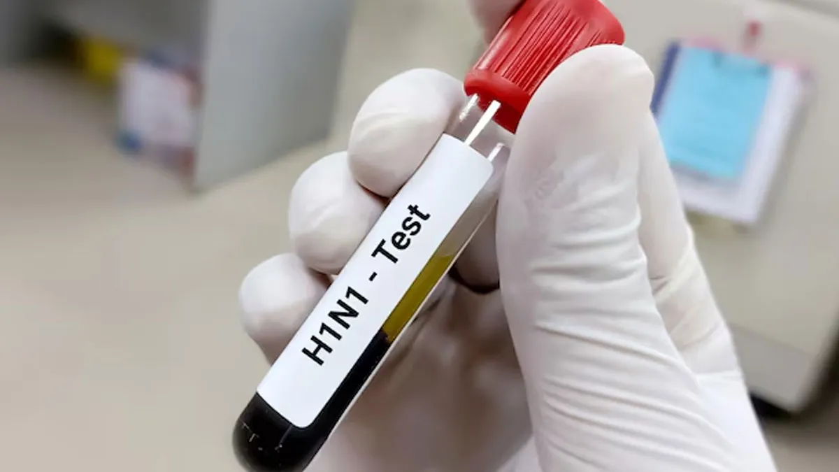 How Long Does Swine Flu Last