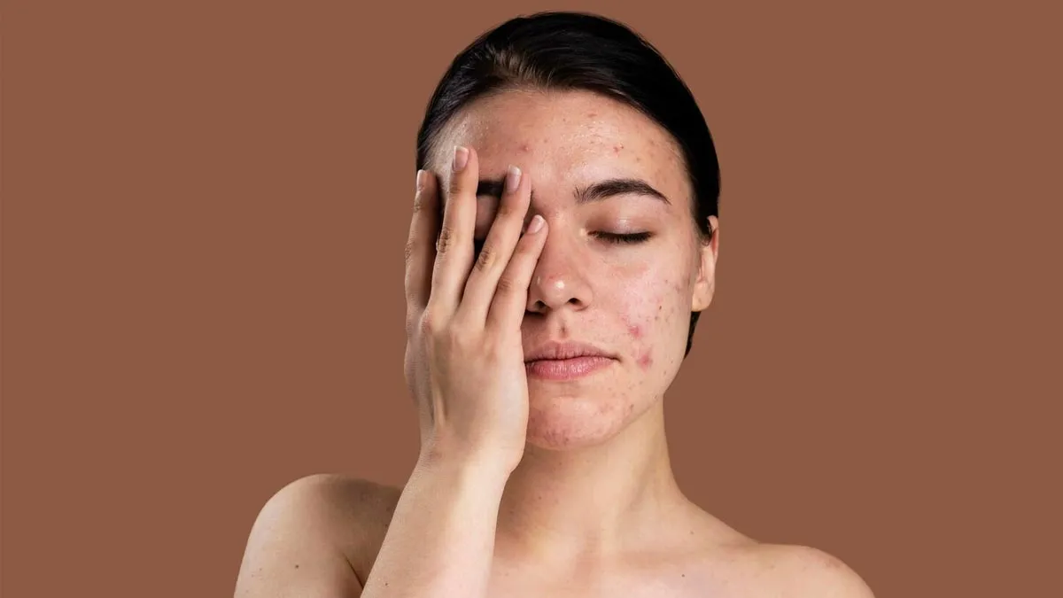 causes-of-pigmentation-on-face-inside