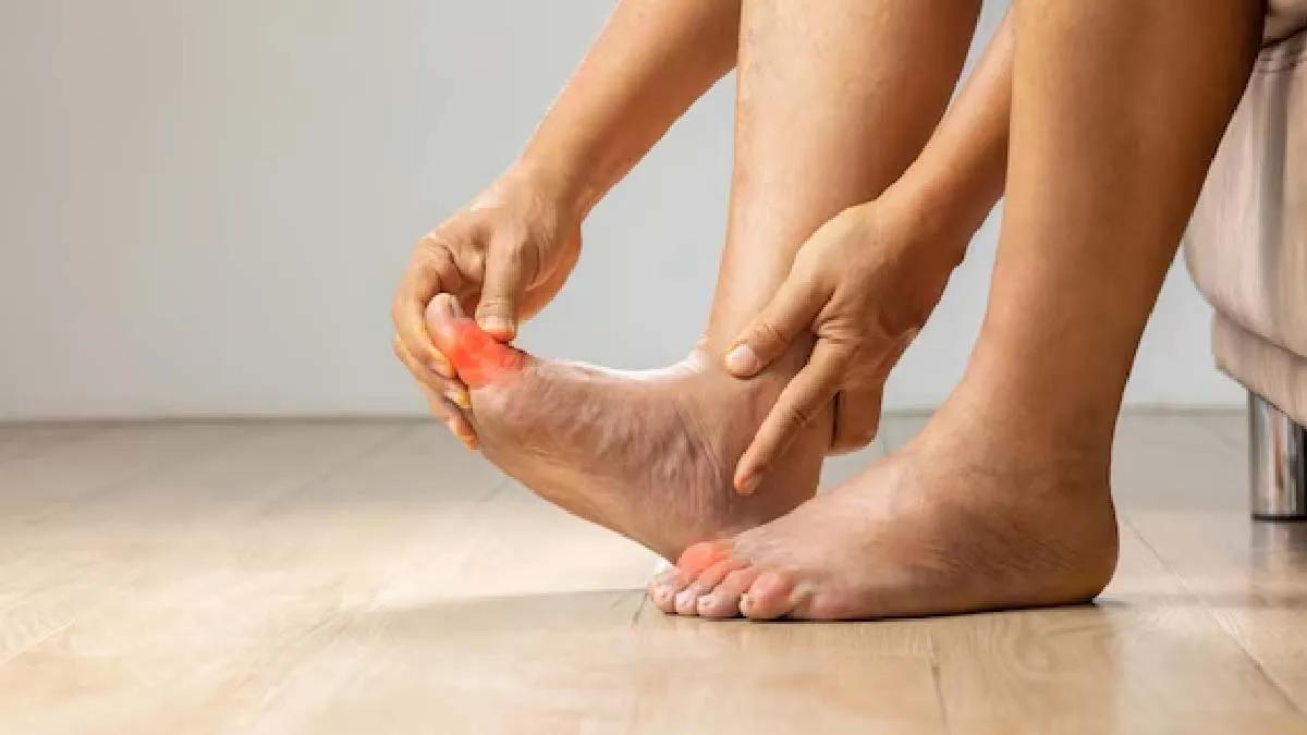 tips-to-reduce-uric-acid-naturally-inside