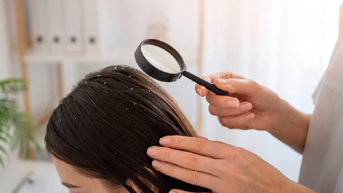 how to use neem water for dandruff removal 01 (1)