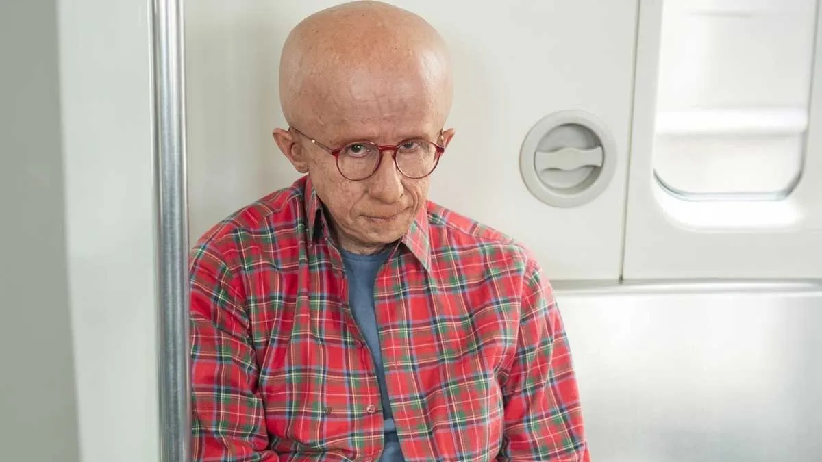 progeria-disease-paa-amitabh-bachchan-movie