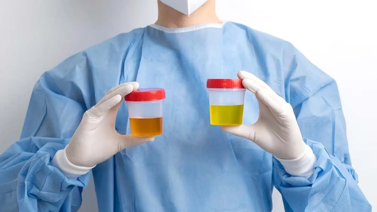 urine-color-and-related-health-problems