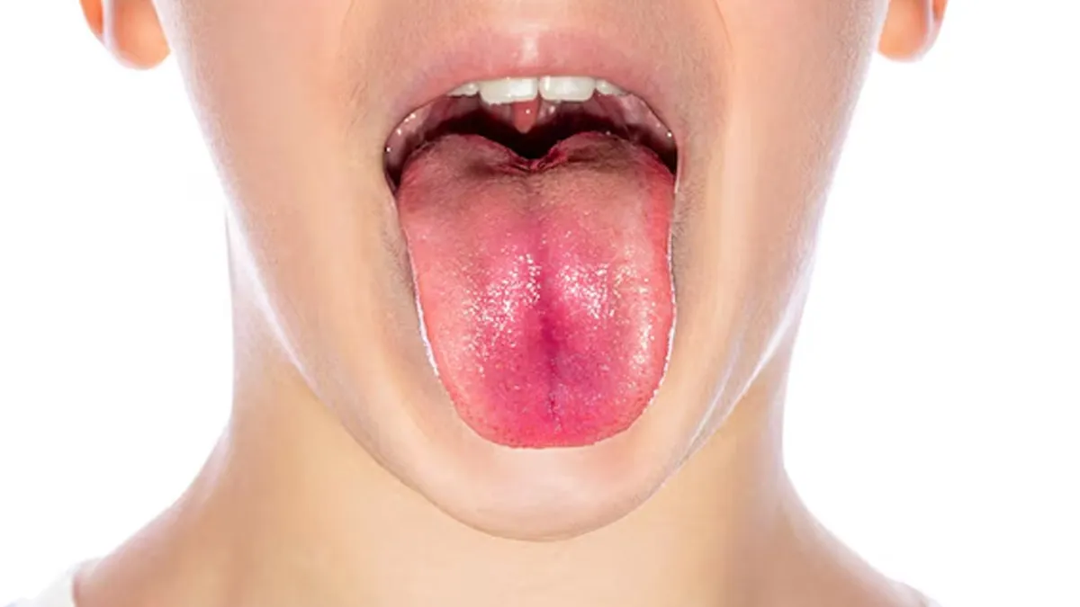 what your tongue color says about your health 1