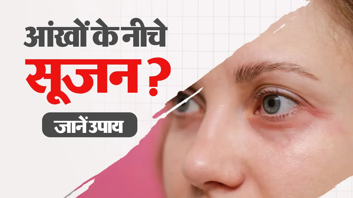 आंखों के नीचे सूजन घटा रही है चेहरे की रौनक? डर्मेटोलॉजिस्ट से जानें Puffy Eyes से छुटकारा पाने के उपाय