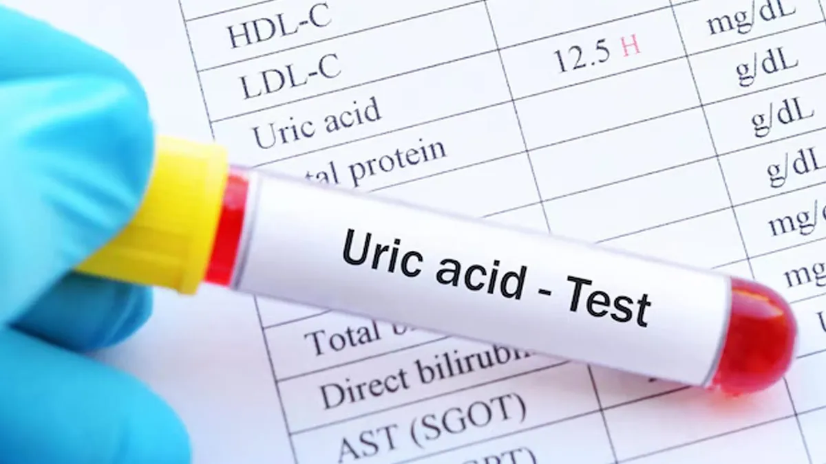 how much time it takes to lower uric acid