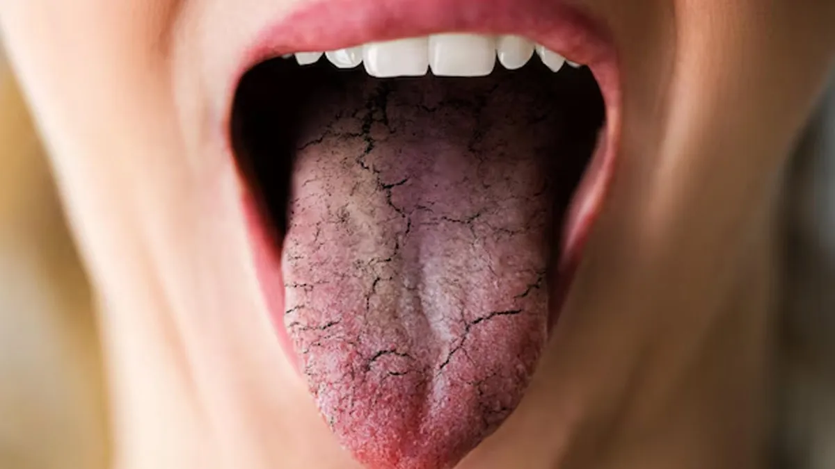 why does your mouth feel dry even after drinking plenty of water 1