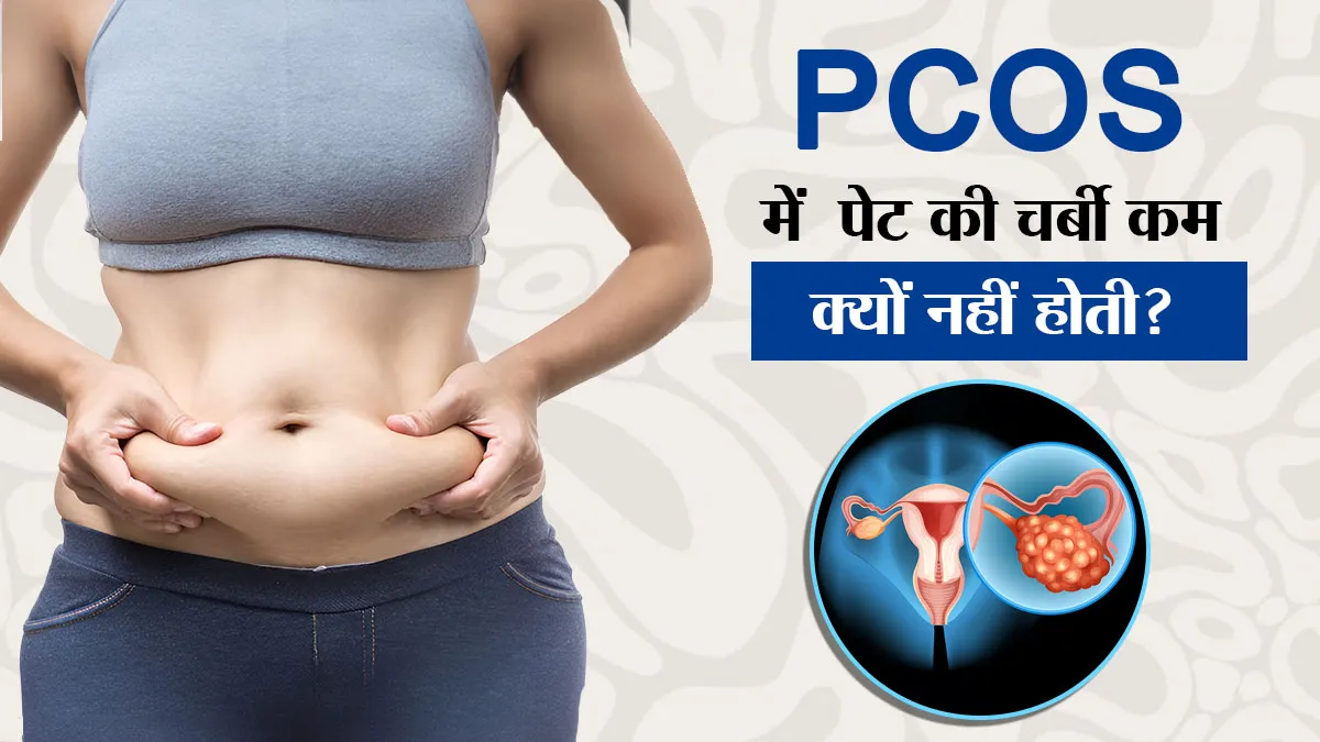 PCOS में वजन कम होने के बाद भी पेट की चर्बी क्यों नहीं जाती? डॉक्टर से समझें